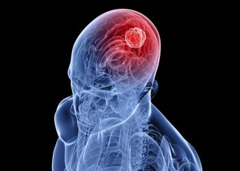 tumor-cerebral tumor-cerebral
